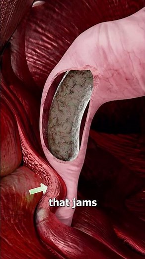 How Squatty Potties Are Better For Pooping 🤔