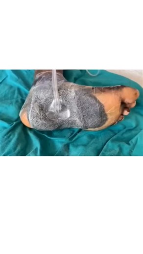 𝐵𝓈𝒸 𝓃𝓊𝓇𝓈𝒾𝓃𝑔 𝓈𝓉𝓊𝒹𝑒𝓃𝓉 | #commentyouranswer👇👇 | Instagram