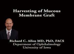 Harvesting of Mucous Membrane Graft