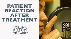 Patient Reaction to Voluma Filler Under The Nose