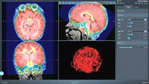 SinoPlan应用教程_SEEG手术计划