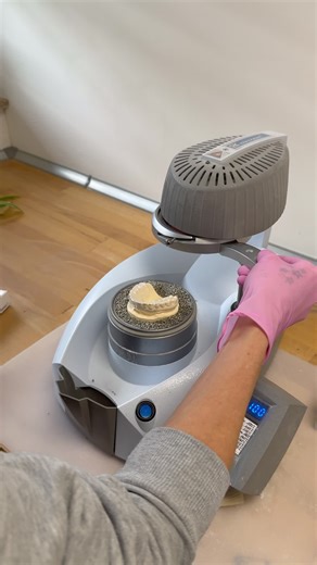 Sport ohne Risiko? Nur mit Zahnschutz. Ein Schlag, ein Sturz oder ein Kontakt – und der Zahn ist weg. Unser maßgefertigter Mundschutz sitzt perfekt, schützt zuverlässig und stört dich beim Atmen oder Sprechen nicht. Perfekt für Boxen, MMA, Hockey & Co. 👉 Wenn du Sport machst: Schütze deine Zähne. #mundschutz #zahnschutz #sportmundschutz #boxmundschutz #zahntechnik