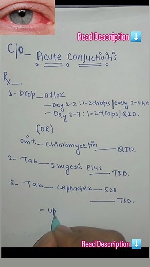 UPDATEDPHARMACY on Instagram: "🚨 Prescription Alert: Acute Conjunctivitis Treatment 📋 Medications Prescribed: 📥Ofloxacin 0.3% Eye Drops Dosage: 1–2 drops in the affected eye every 2–4 hours for the first 2 days, then 4 times daily for the next 5 days. Mechanism: A fluoroquinolone antibiotic that inhibits bacterial DNA gyrase, preventing DNA replication and leading to bacterial cell death. 📥Chloramphenicol 1% Eye Ointment Dosage: Apply a 1 cm ribbon inside the lower eyelid of the affected eye