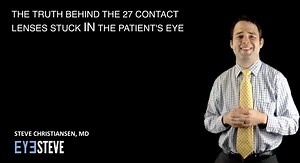 The Truth Behind the 27 Contact Lenses Stuck in the Patient's Eye - EyeSteve.com