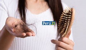 Caída de cabello puede ser síntoma de anemia: Conoce AQUÍ otras señales (VIDEO)