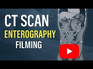 CT Scan Enterography Filming | Abdomen Contrast & Thorax CT Procedure Explained