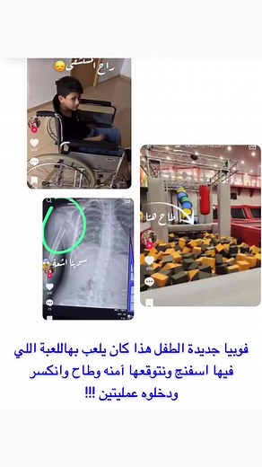 Understanding Spinal Health Through X-ray Imaging