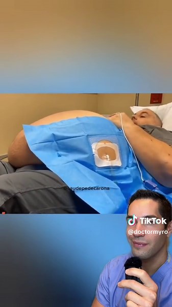 Incredible relief for the patient (although temporary) #doctor #paracentesis #humanbody #medicine #transformation