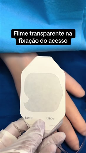 Importância do Filme Transparente no Acesso Venoso