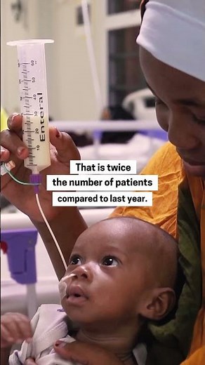 Severe malnutrition rise among children in northern Nigeria