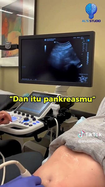 Mahasiswi Praktek USG Temukan Kejadian Mengejutkan