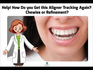 How to Get an Aligner Unseat Tracking Again- Backtrack, Back=Tracking, Backtracking Invisalign