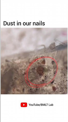 Nails🥶germs😲🤢 under the microscope 🤧🔬 view 😲#experiment#viral#doctor#lab#bmlt#dmlt#mbbs#shorts .