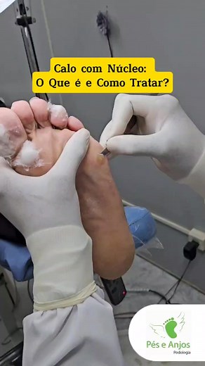 Podologia Pés e Anjos no TikTok