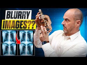 Why Your X-ray Images Are Blurry? (And how to fix it) | X-ray University