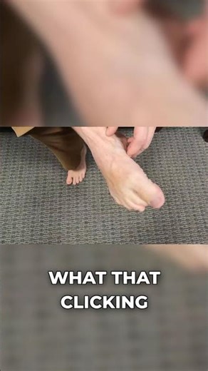 Mystery Clicking in My Post-Surgery Toe!