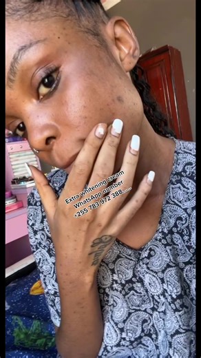 Before And After Extra whitening cream……See the results 😍