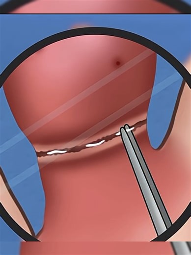 ASMR Finger Treatment Techniques for Relaxation