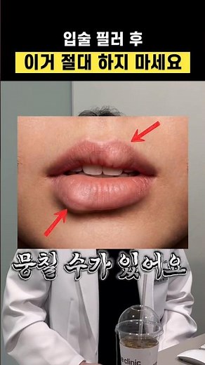 Lip Filler Aftercare: Swelling, Bruising, & Recovery Time Explained | Gangnam Seye Clinic
