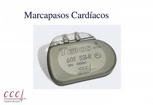 Marcapasos Cardíacos - SlideServe