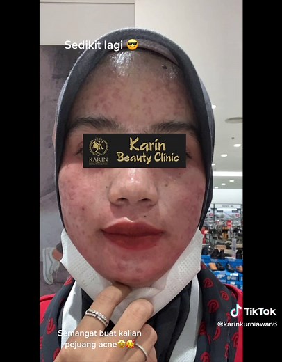 Karin beauty clinic on TikTok