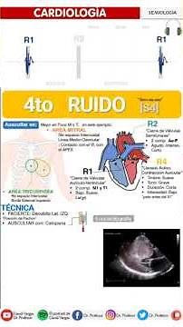 S4 Heart Sound | CUARTO (R4) RUIDO CARDIACO - SEMIOLOGÍA FÁCIL Auscultación Cardíaca (galope-normal)
