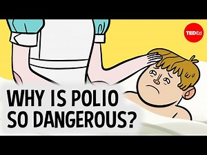 The real reason polio is so dangerous - Videos For Kids