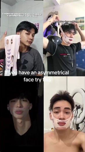 Solutions for Achieving a Symmetrical Face