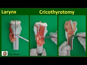 Larynx, Laryngitis, Cricothyrotomy