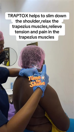 Traptox, also known as Trap Tox, is a cosmetic treatment that involves injecting Botox into the trapezius muscle to relax it, reducing its appearance and relieving tension. Here's what it's about: What it does - Relaxes the trapezius muscle, which runs from the neck to the shoulders - Can slim the appearance of the neck and shoulders - Relieves tension and pain in the trapezius muscle - Can help with posture and reduce headaches Why people get it - Aesthetic purposes, like achieving a more slend