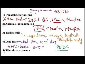 USMLE ACE Video 171: Microcytic Anemia