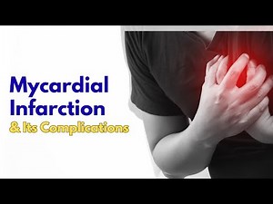 Myocardial Infarction Explained: Pathophysiology, Management & Complications