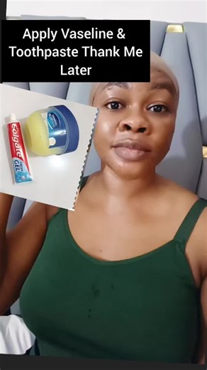 Vaseline and Toothpaste Mix for Smooth Skin