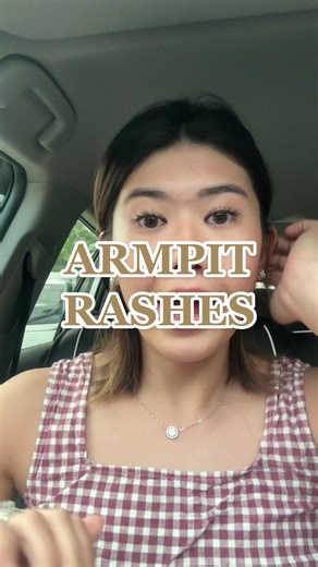 Armpit Rashes: Diagnosis and Treatment at DMV Derma Clinic