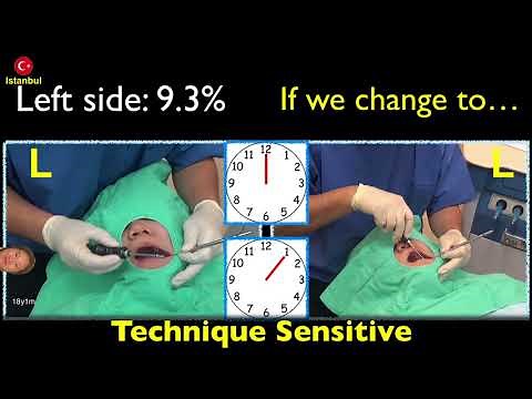 OBS TAD applications Part 1｜【Chris Chang Ortho】CC481