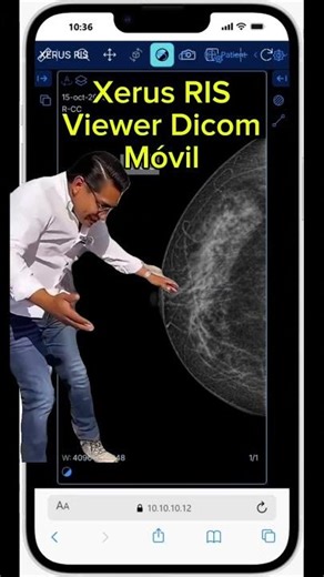 Quieres el Viewer Dicom para Android y IOS 👉 #radiologiadigital ‪@ACRadiologia‬ ‪@acro_colombia‬