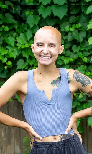 I'm Bald But I Still Feel 'Feminine' 👩🏻‍🦲❤️ | Shake My Beauty