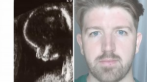 Dad began 30-year age-progression video of his son with his 1991 ultrasound image