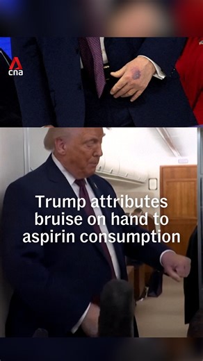 US President Donald Trump blamed a noticeable bruise on his left hand on his high intake of aspirin. Speaking to reporters on Thursday (Jan 22), he said the bruise appeared after he bumped a table at the World Economic Forum in Davos. Trump has been seen with frequent bruising on his right hand since returning to the White House last year, often concealing it with bandages and makeup. https://cna.asia/4jRaDmi #donaldtrump #usnews | CNA