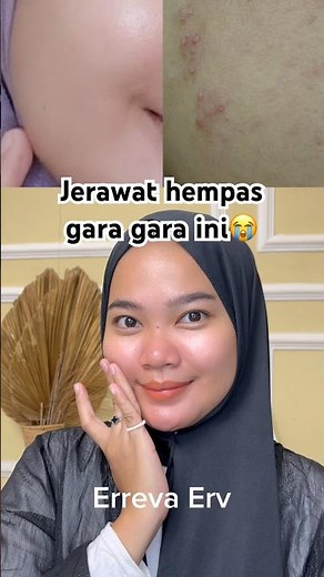 How to treat acne-prone facial skin | Whitelab Acne Calming Serum Review