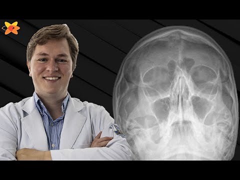 RADIOGRAFIA DOS SEIOS DA FACE (RX DOS SEIOS PARANASAIS)