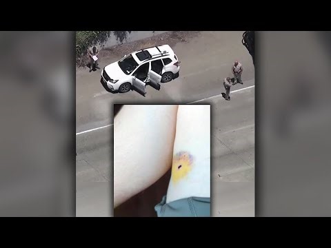 Victim of freeway shooting in San Francisco speaks out