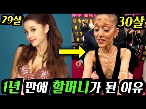 팝요정의 비극...아리아나 그란데가 재산이 많은데도 마음의 병이 생긴 이유