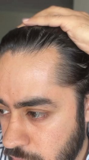 Head 2 Toe on Instagram: "Comment “HAIR” for link or share this reel in my DM for link if you're experiencing hairfall or hairloss then this video is for you. Our goal in this video is to stop hairfall and regrow hair increase hair density. Hair Loss or Hair fall can be worrying and scary but the good news is, there's often a way to fix it. Here are easy steps to control your hair loss & is an ultimate hair care routine. Shampoo Use a shampoo that's right for your hair type. For example, if you 