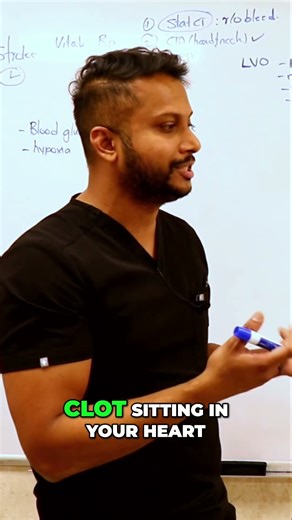 Thrombotic vs. Embolic: Decoding Brain Imaging #shorts