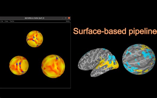 表层空间(surface-based)fMRI处理:05 把结果映射到MNI空间