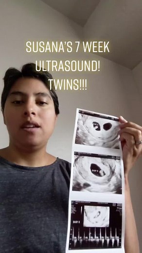 7 Week Twin Pregnancy Ultrasound: Twins Update and Pregnancy Announcement