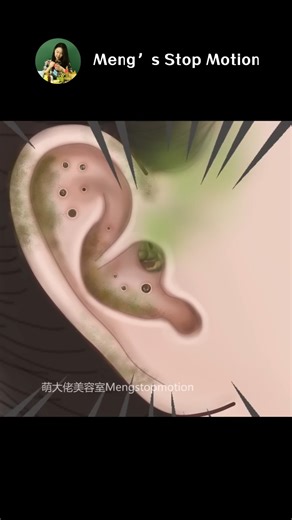328K views · 3.1K reactions | OMG!Ear Cleaning Animation - Meng's Stop Motion #ASMR #Animation #healing | Meng's Stop Motion | Facebook