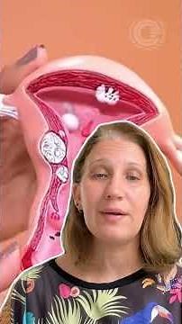 🚨 Endometriose: o que é, principais sintomas e por que o diagnóstico demora tanto?