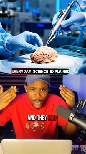 Doctors operate on your Brain while you’re Awake 😳 #neuroscience #sciencefacts #brain #medical